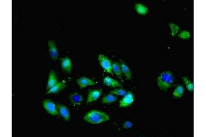 anti-Chemokine (C-X3-C Motif) Ligand 1 (CX3CL1) (AA 25-100) antibody