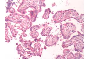 Human Placenta: Formalin-Fixed, Paraffin-Embedded (FFPE) (BDKRB1 anticorps  (C-Term))