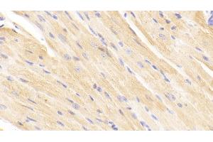 Detection of TIMP2 in Mouse Cardiac Muscle Tissue using Polyclonal Antibody to Tissue Inhibitors Of Metalloproteinase 2 (TIMP2) (TIMP2 anticorps  (AA 27-220))