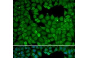 Immunofluorescence analysis of HeLa cells using NET1 Polyclonal Antibody (NET1 anticorps)