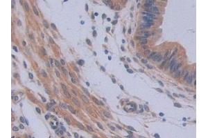 DAB staining on IHC-P; Samples: Mouse Uterus Tissue (IL12A anticorps  (AA 23-215))