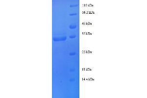 Insulin-Like Growth Factor 1 (IGF1) (AA 49-118) protein (GST tag)
