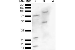 Western blot analysis of Human, Mouse brain lysate showing detection of ~16 kDa Alpha Synuclein pSer129 protein using Rabbit Anti-Alpha Synuclein pSer129 Polyclonal Antibody (ABIN5650949). (SNCA anticorps  (pSer129) (HRP))