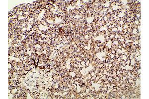 ABIN6267452 at 1/100 staining mouse lung tissue sections by IHC-P.