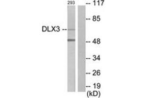 Western blot analysis of extracts from 293 cells, using DLX3 Antibody.