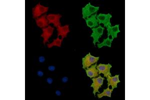 ABIN7095677 and ABIN7099739 staining HepG2 cells by IF/ICC. (PLA2G10 anticorps)