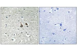 Immunohistochemical analysis of paraffin-embedded human brain tissue using IRAK1 (Phospho-Ser376) antibody (left)or the same antibody preincubated with blocking peptide (right). (IRAK1 anticorps  (pSer376))