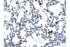 Rabbit Anti-E2F6 antibody        Paraffin Embedded Tissue:  Human Lung cell   Cellular Data:  Epithelial cells of renal tubule  Antibody Concentration:   4.