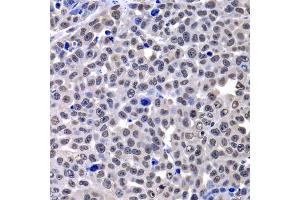 Immunohistochemistry of paraffin-embedded mouse cancer using H2AFY antibody (ABIN5974238) at dilution of 1/100 (40x lens). (H2AFY anticorps)