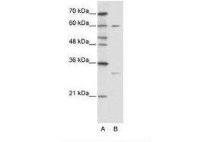 Image no. 1 for anti-Zinc Finger Protein 395 (ZNF395) (AA 361-410) antibody (ABIN6736114) (ZNF395 anticorps  (AA 361-410))