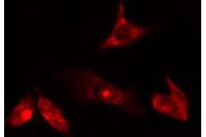 ABIN6274763 staining HuvEc cells by IF/ICC. (AZI1 anticorps  (C-Term))