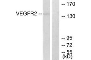 Western blot analysis of extracts from 293 cells, treated with LPS 100ng/ml 30', using VEGFR2 (Ab-1214) Antibody. (VEGFR2/CD309 anticorps  (AA 1180-1229))