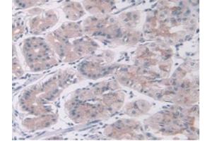 IHC-P analysis of Human Stomach Tissue, with DAB staining. (KEAP1 anticorps  (AA 327-624))