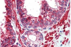 Human Prostate (formalin-fixed, paraffin-embedded) stained with TFAP2C antibody ABIN462192 followed by biotinylated goat anti-rabbit IgG secondary antibody ABIN481713, alkaline phosphatase-streptavidin and chromogen.