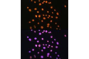 Immunofluorescence analysis of C6 cells using NR2F2 Rabbit pAb (ABIN6133831, ABIN6144820, ABIN6144821 and ABIN6214430) at dilution of 1:100.