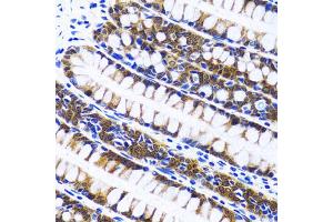 Immunohistochemistry of paraffin-embedded human colon using FASN antibody. (Fatty Acid Synthase anticorps)