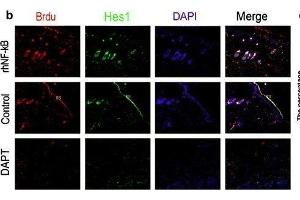 The relationships of the Wnt and Notch signaling pathway and the proliferation of epidermal stem cells was analyzed by immunofluorescence. (HES1 anticorps  (AA 41-150))