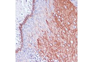 Immunohistochemistry of paraffin-embedded human esophageal using WIPF1 antibody (ABIN7271348) at dilution of 1:100 (40x lens). (WIPF1 anticorps  (AA 400-500))