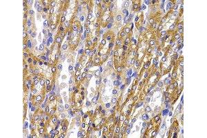 Immunohistochemistry of paraffin-embedded Rat kidney using ATP1A1 Polyclonal Antibody at dilution of 1:100 (40x lens). (ATP1A1 anticorps)