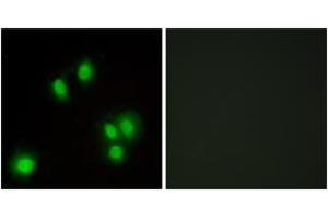 Immunofluorescence analysis of A549 cells, using GA45G Antibody. (GADD45G anticorps  (AA 101-150))