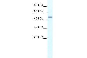 WB Suggested Anti-TRIM39 Antibody Titration:  1. (TRIM39 anticorps  (N-Term))