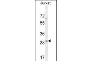 LRRC25 Antibody (C-term) (ABIN654519 and ABIN2844242) western blot analysis in Jurkat cell line lysates (35 μg/lane). (LRRC25 anticorps  (C-Term))