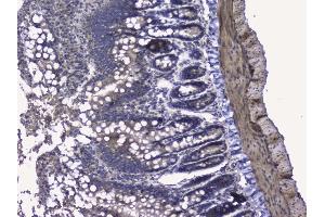 IHC analysis of RALBP1 using anti-RALBP1 antibody (ABIN5692936). (RALBP1 anticorps  (AA 239-506))