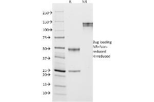 SDS-PAGE Analysis Purified CD10 Mouse Monoclonal Antibody (MME/1870).