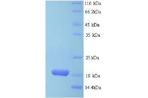 SDS-PAGE (SDS) image for Basic Leucine Zipper Transcriptional Factor ATF-Like 3 (BATF3) (AA 1-133), (full length) protein (His tag) (ABIN5713272)