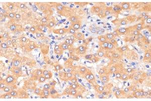 Immunohistochemistry of paraffin-embedded Human liver using PDCD2L Polyclonal Antibody at dilution of 1:100 (40x lens).