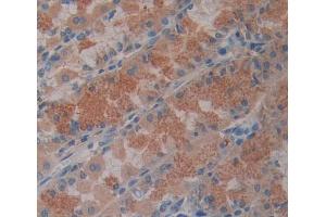 Used in DAB staining on fromalin fixed paraffin- embedded stomach tissue