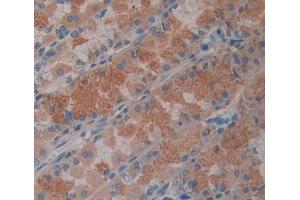 Used in DAB staining on fromalin fixed paraffin- embedded stomach tissue (ABCB8 anticorps  (AA 472-735))
