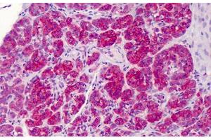 Human Pancreas: Formalin-Fixed, Paraffin-Embedded (FFPE)