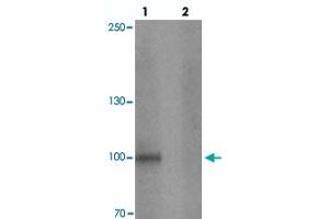 Western blot analysis of STOX1 in human liver tissue with STOX1 polyclonal antibody  at 1 ug/mL in (lane 1) the absence and (lane 2) the presence of blocking peptide. (STOX1 anticorps  (C-Term))
