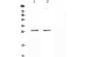 Western blot analysis of SPR using anti-SPR antibody . (SPR anticorps  (AA 36-261))