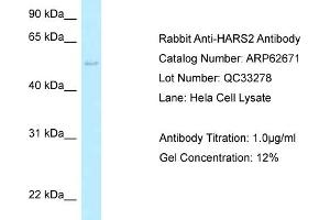 Western Blotting (WB) image for anti-Histidyl-tRNA Synthetase 2, Mitochondrial (Putative) (HARS2) (C-Term) antibody (ABIN2789202)