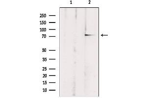 Western blot analysis of extracts from rat brain, using ABCB10 Antibody.