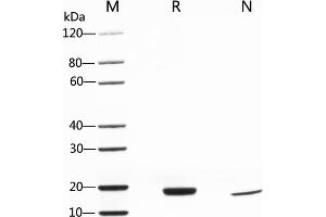 2 μg of IL-6, Human was resolved with SDS-PAGE under reducing (R) and non-reducing (N) conditions and visualized by Coomassie Blue staining.