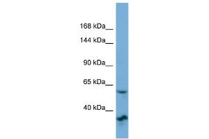 Host:  Rabbit  Target Name:  OSBP2  Sample Type:  OVCAR-3 Whole cell lysates  Antibody Dilution:  1. (OSBP2 anticorps  (N-Term))