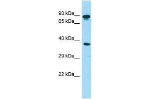 WB Suggested Anti-HOOK3 Antibody Titration: 1. (HOOK3 anticorps  (C-Term))