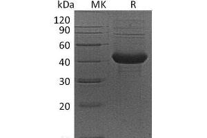 Western Blotting (WB) image for Activin A Receptor, Type IB (ACVR1B) protein (Fc Tag) (ABIN7320467)