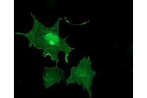 Anti-LIMK1 mouse monoclonal antibody (ABIN2454574) immunofluorescent staining of COS7 cells transiently transfected by pCMV6-ENTRY LIMK1 (RC218058). (LIM Domain Kinase 1 anticorps)