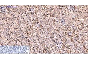 Immunohistochemistry of paraffin-embedded Rat kidney tissue using CD5 Monoclonal Antibody at dilution of 1:200. (CD5 anticorps)