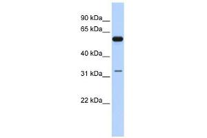 DDX28 antibody used at 1 ug/ml to detect target protein. (DDX28 anticorps)