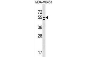 Western Blotting (WB) image for anti-phosphatidylserine Synthase 1 (PTDSS1) antibody (ABIN2999231) (PTDSS1 anticorps)