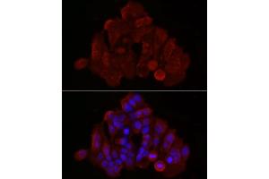 Immunofluorescence analysis of MCF7 cells using [KO Validated] Bax Rabbit pAb (ABIN3020682, ABIN3020683, ABIN3020684, ABIN1512622 and ABIN6213665) at dilution of 1:50 (40x lens). (BAX anticorps  (AA 1-100))