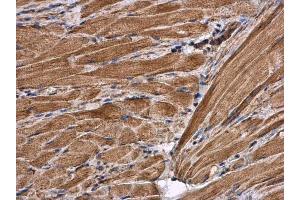 IHC-P Image Citrate synthetase antibody [N2C3] detects Citrate synthetase protein at cytoplasm in mouse muscle by immunohistochemical analysis.