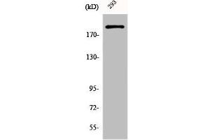 Western Blot analysis of 293 cells using Dio-1 Polyclonal Antibody (DIDO1 anticorps  (N-Term))