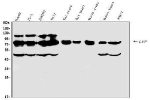 Western blot analysis of LPP using anti-LPP antibody (ABIN7599606).