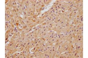 IHC image of ABIN7175041 diluted at 1:100 and staining in paraffin-embedded human heart tissue performed on a Leica BondTM system.